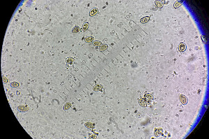 : Inocybe phaeodisca