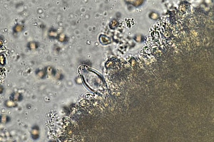 : Inocybe phaeodisca