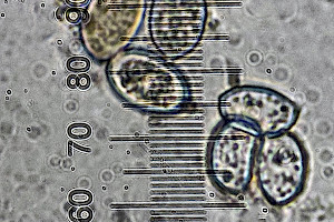 Stubble Rosegill: Volvopluteus gloiocephalus