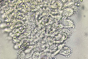 : Mycena metata