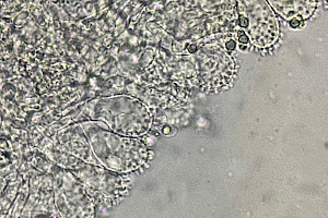: Mycena metata