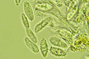: Petractis clausa