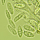 Petractis clausa