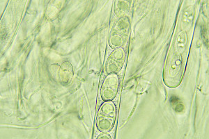 : Acrocordia gemmata