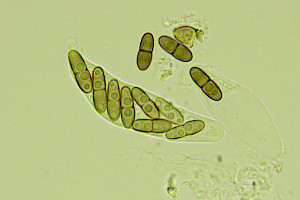 : Sphaerellothecium parietinarium