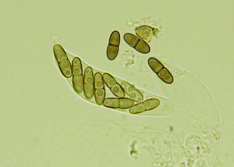 Sphaerellothecium parietinarium - &copy; Barry Stewart