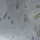 Xerocomus ferrugineus